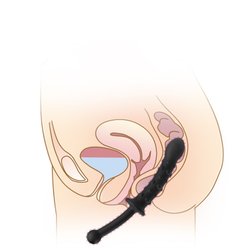 Plug anal et vaginal en silicone 25 cm